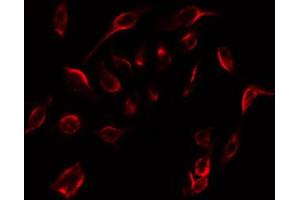 ABIN6267276 staining 293 by IF/ICC. (Estrogen Receptor alpha Antikörper  (pSer104))