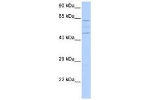 Image no. 1 for anti-Vacuolar Protein Sorting 37 Homolog A (VPS37A) (N-Term) antibody (ABIN6741204) (VPS37A Antikörper  (N-Term))