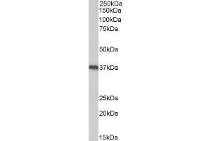 Western Blotting (WB) image for anti-Uncoupling Protein 2 (Mitochondrial, Proton Carrier) (UCP2) (Internal Region) antibody (ABIN5539644)