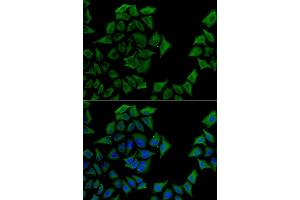 Immunofluorescence analysis of U2OS cells using TCN1 antibody. (TCN1 Antikörper)