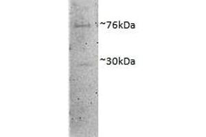 ABIN4902609 (1µg/ml) staining of Porcine MII Oocytes lysate (35µg protein in RIPA buffer). (DVL1 Antikörper)