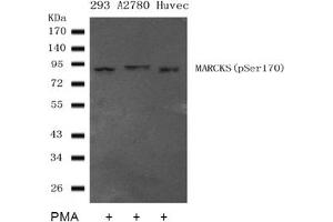 Image no. 2 for anti-Myristoylated Alanine-Rich Protein Kinase C Substrate (MARCKS) (pSer170) antibody (ABIN401559)