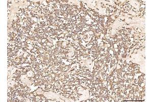 IHC analysis of BHMT using anti-BHMT antibody (ABIN7599940). (BHMT Antikörper  (AA 13-386))