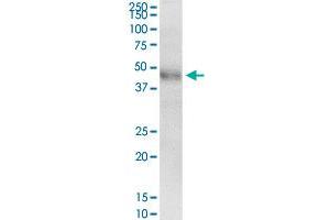 KRT8 MaxPab rabbit polyclonal antibody. (KRT8 Antikörper  (AA 1-483))