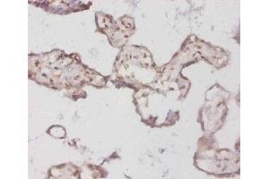 Immunohistochemistry of paraffin-embedded human placenta tissue using ABIN7145688 at dilution of 1:50 (BMP3 Antikörper  (AA 362-472))