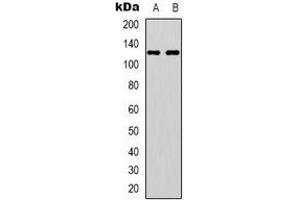 Western blot analysis of EPHA4 (pY596) expression in HUVEC (A), Hela (B) whole cell lysates.