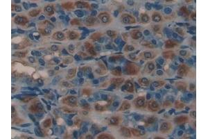 Detection of HCII in Rat Intestine Tissue using Polyclonal Antibody to Heparin Cofactor II (HCII)