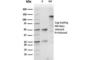 SDS-PAGE Analysis of Purified Cytokeratin 10 Rabbit Recombinant Monoclonal Antibody (KRT10/1948R). (Rekombinanter Keratin 10 Antikörper)