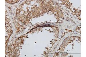 Image no. 1 for anti-phosphoinositide Kinase, FYVE Finger Containing (PIKFYVE) (AA 342-452) antibody (ABIN599337) (PIKFYVE Antikörper  (AA 342-452))