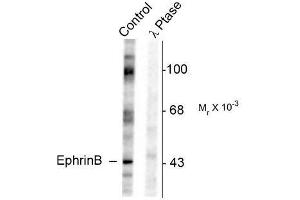 Image no. 1 for anti-Ephrin B1 (EFNB1) (pTyr317) antibody (ABIN372620) (Ephrin B1 Antikörper  (pTyr317))