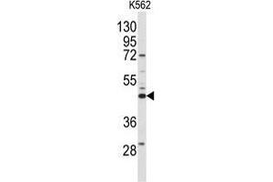 Western blot analysis of anti-SPHK1 Antibody (N-term) in K562 cell line lysates (35 µg/lane). (SPHK1 Antikörper  (N-Term))