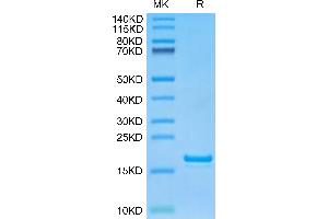 MPXV L1R (AA 1-152) protein (His tag)