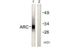 Western blot analysis of extracts from HeLa cells, using ARC Antibody. (ARC (AA 159-208) Antikörper)