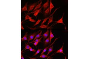 Immunofluorescence analysis of NIH-3T3 cells using Rac1/2/3 Rabbit pAb (ABIN6129317, ABIN6146616, ABIN6146618 and ABIN6223653) at dilution of 1:100 (40x lens). (RAC1 Antikörper  (AA 1-192))