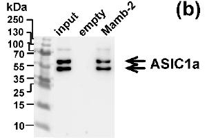 Western blot analysis of the ASIC1 subunits extraction from membrane fraction of mel P cells by affinity chromatography on NHS-sepharose resin coupled with mambalgin-2 (n = 3). (ASIC1 Antikörper  (Extracellular Domain))