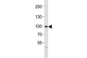 Western blot analysis of lysate from SW480 cell line using FGFR4 antibody at 1:1000.