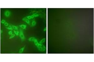 Immunofluorescence analysis of A549 cells, using Stefin B Antibody. (CSTB Antikörper  (AA 49-98))