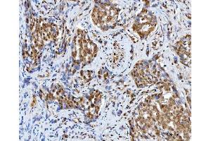 IHC analysis of BAF57/SMARCE1 using anti-BAF57/SMARCE1 antibody (ABIN7600326).