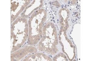ABIN6267571 at 1/200 staining human kidney tissue sections by IHC-P.