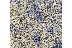 IHC analysis of CD79b using anti-CD79b antibody (ABIN3043398). (CD79b Antikörper  (AA 29-229))