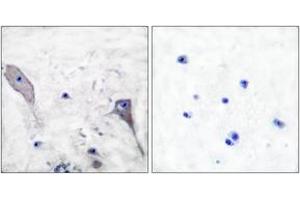 Immunohistochemistry analysis of paraffin-embedded human brain tissue, using Patched Antibody. (Patched 1 Antikörper  (AA 1-50))