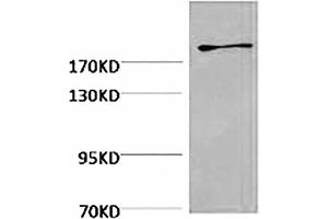 Western blot analysis of Hela, diluted at 1:2000.