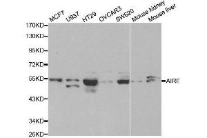 Western blot analysis of extracts of various cell lines, using AIRE antibody. (AIRE Antikörper  (AA 30-130))
