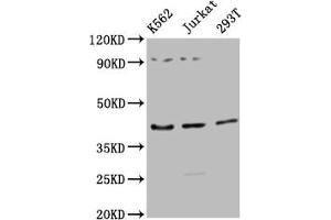 Western Blot Positive WB detected in: K562 whole cell lysate, Jurkat whole cell lysate, 293T whole cell lysate All lanes: ADIPOR1 antibody at 1:2500 Secondary Goat polyclonal to rabbit IgG at 1/50000 dilution Predicted band size: 43 kDa Observed band size: 43 kDa (Adiponectin Receptor 1 Antikörper  (AA 1-63))