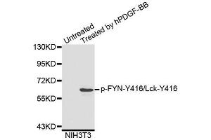 Western blot analysis of extracts of NIH3T3 cells, using Phospho-FYN-Y416/Lck-Y416 antibody (ABIN5995595). (FYN Antikörper  (pTyr416))