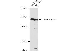 Western blot analysis of extracts of various cell lines, using Leptin Receptor antibody (ABIN3017145, ABIN3017146, ABIN3017147 and ABIN6219976) at 1:1000 dilution. (Leptin Receptor Antikörper)