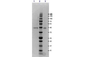 SDS-PAGE results of ERK1 double mutant recombinant Protein.