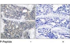 Image no. 1 for anti-Ribosomal Protein S6 Kinase, 70kDa, Polypeptide 1 (RPS6KB1) (pThr421) antibody (ABIN197014) (RPS6KB1 Antikörper  (pThr421))