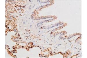 ABIN6267364 at 1/200 staining Rat lung tissue sections by IHC-P.
