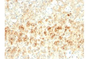 Formalin-fixed, paraffin-embedded human Adrenal Gland stained with Adipophilin Recombinant Rabbit Monoclonal Antibody (ADFP/2755R). (Rekombinanter ADRP Antikörper  (AA 249-376))