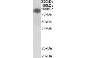 ABIN571072 (0. (PRDM1 Antikörper  (Internal Region))