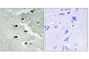 Immunohistochemistry analysis of paraffin-embedded human brain tissue using CDCA4 antibody. (CDCA4 Antikörper  (Internal Region))