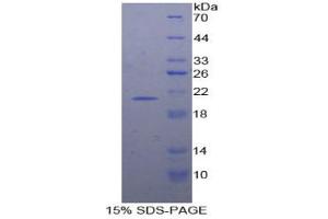 SDS-PAGE analysis of Human Interferon alpha 7 Protein. (IFNA7 Protein)