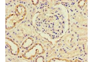 Immunohistochemistry of paraffin-embedded human kidney tissue using ABIN7146119 at dilution of 1:100 (CXCL11 Antikörper  (AA 22-94))
