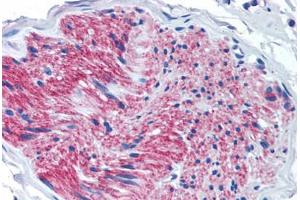 Immunohistochemistry (IHC) image for anti-Purinergic Receptor P2X, Ligand-Gated Ion Channel, 7 (P2RX7) (Internal Region) antibody (ABIN1049197)