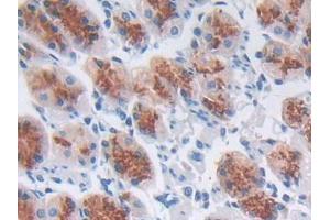 DAB staining on IHC-P; Samples: Human Stomach Tissue (CCL8 Antikörper  (AA 1-99))