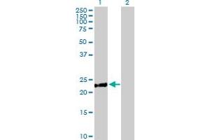 Western Blot analysis of DCAKD expression in transfected 293T cell line by DCAKD MaxPab polyclonal antibody. (DCAKD Antikörper  (AA 1-231))