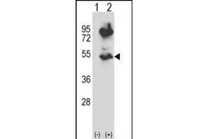 Western blot analysis of HTRA2 (arrow) using rabbit polyclonal HTRA2 Antibody (N-term) (ABIN657628 and ABIN2846624). (HTRA2 Antikörper  (N-Term))