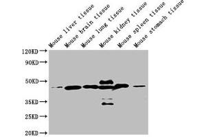 Western Blot Positive WB detected in: Mouse liver tissue, Mouse brain tissue, Mouse lung tissue, Mouse kidney tissue, Mouse spleen tissue, Mouse stomach tissue All lanes: ACTB antibody at 1:5000 Secondary Goat polyclonal to mouse IgG at 1/50000 dilution Predicted band size: 42 KDa Observed band size: 42 KDa Exposure time: 5 min