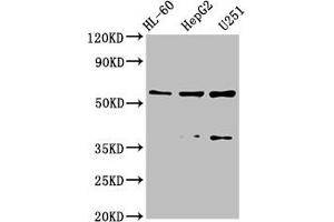 Western Blot Positive WB detected in: HL-60 whole cell lysate, HepG2 whole cell lysate, U251 whole cell lysate All lanes: ENTPD1 antibody at 2. (CD39 Antikörper  (AA 316-474))