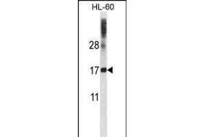 DNAL4 Antibody (N-term) (ABIN657490 and ABIN2846517) western blot analysis in HL-60 cell line lysates (35 μg/lane).