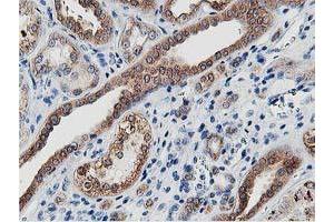 Image no. 8 for anti-Leucine Carboxyl Methyltransferase 1 (LCMT1) antibody (ABIN1499107) (LCMT1 Antikörper)