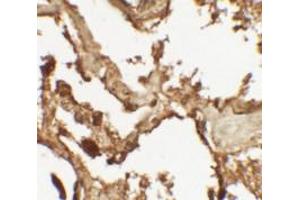 Immunohistochemical analysis of VKORC1 in human lung tissue with VKORC1 polyclonal antibody  at 2.