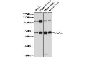 Western blot analysis of extracts of various cell lines, using GLCCI1 antibody (ABIN7267395) at 1000 dilution. (GLCCI1 Antikörper  (AA 120-230))