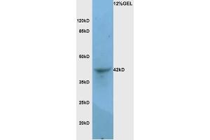 Mouse lung lysates probed with Rabbit Anti-LAMP-1 Polyclonal Antibody, Unconjugated  at 1:3000 for 90 min at 37˚C. (LAMP1 Antikörper  (AA 301-417))