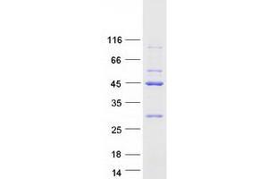 Western Blotting (WB) image for Eukaryotic Translation Initiation Factor 2B, Subunit 2 Beta, 39kDa (EIF2B2) protein (Myc-DYKDDDDK Tag) (ABIN2720061)